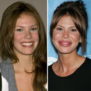 Nikki Cox Plastic Surgery CHEEKS