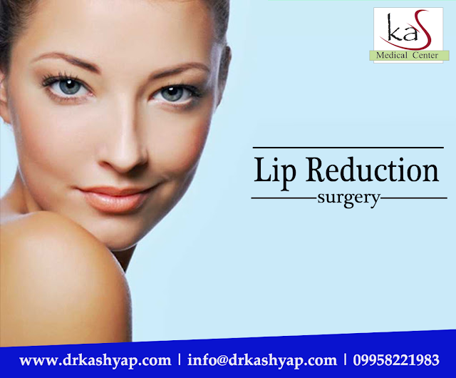 #lipreduction #lipsplasticsurgerycost #lipsreshaping #beautifullips