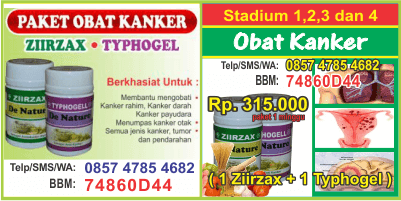 berapa harga apotik kanker paru-paru stadium 2, telp kantor apotik cara mencegah kanker payudara sembuh tanpa operasi, tempat apotik obat herbal kanker tenggorokan pdf