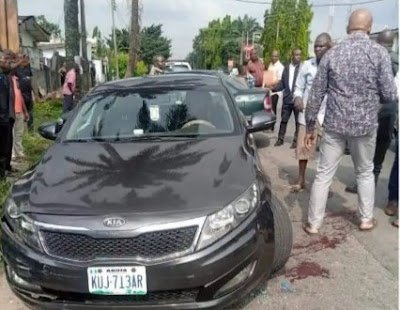 Tragedy As Assassins Shoot Man In The Face In Port Harcourt (Graphic Photos)