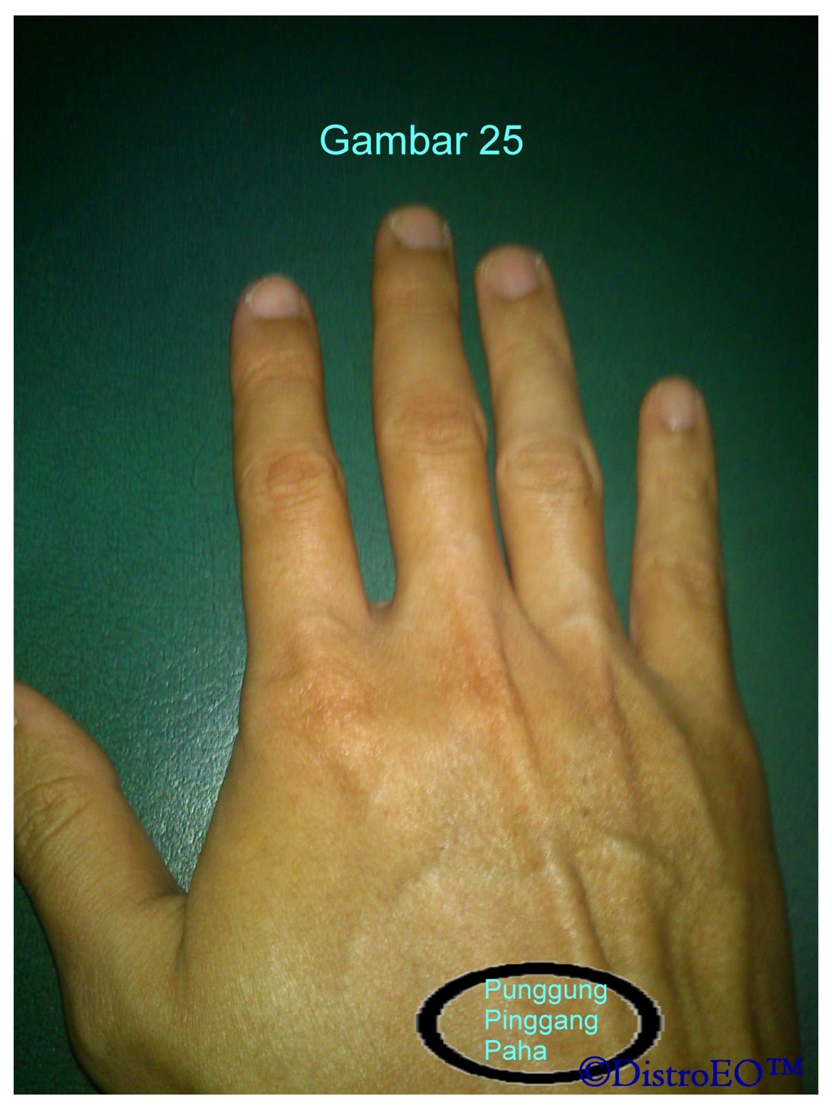 Titik Telapak Tangan (3T) dan manfaatnya Orgonite 3T 