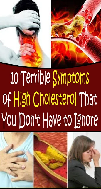 10 Symptoms Of High Cholesterol That You Shouldn’t Ignore