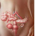 Prevenção do Câncer de ovário - cancro do ovário e significativa na gordura corporal e carne Dietas