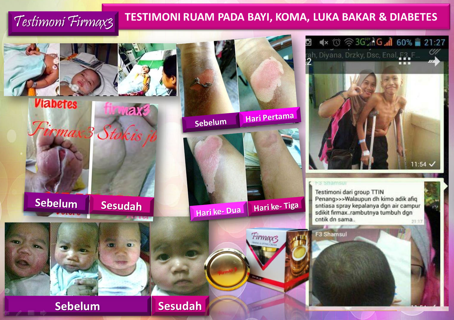 Testimoni Firmax3 Cream Indonesia