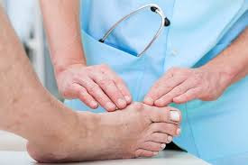 Asam urat atau yang biasa disebut dengan gout adalah kondisi dimana seseorang merasakan rasa nyeri yang tidak tertahankan