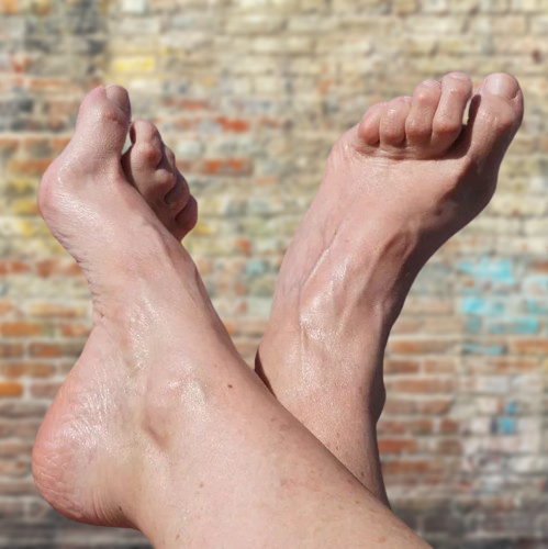 Hammer toes after surgery Pictures/Images
