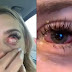 Jovem fica com 'olhos de zumbi' após fazer extensões de cílios: 'Achei que ficaria cega'