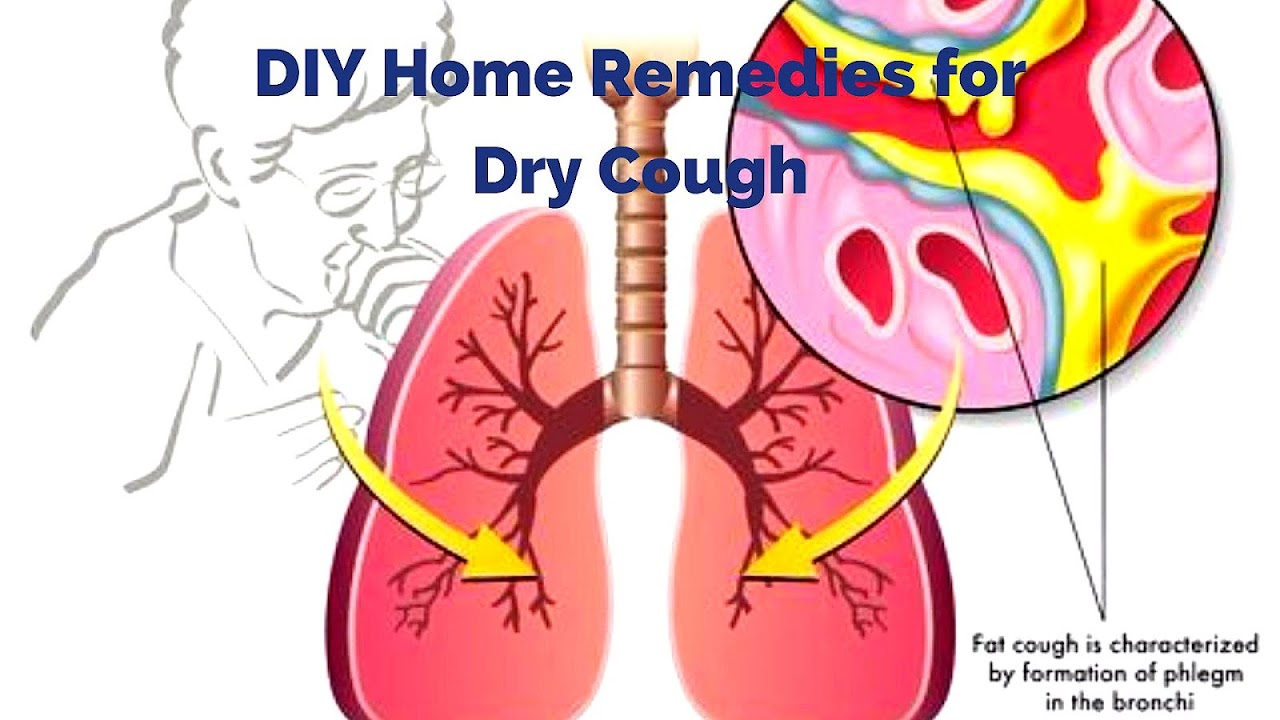 Cough - Dry Coughing Symptoms