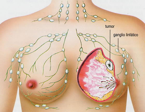 Oct Chemotherapy Is One Of The Treatment Methods Right In Ludicrous Cancer Causing Cells By The Usage Of Drugs This Tracing Scene Is Carried Through 