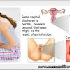 Cara Merawat Vagina