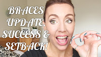 http://www.wagdoll.co.uk/2016/07/adult-braces-update-week-8-success.html