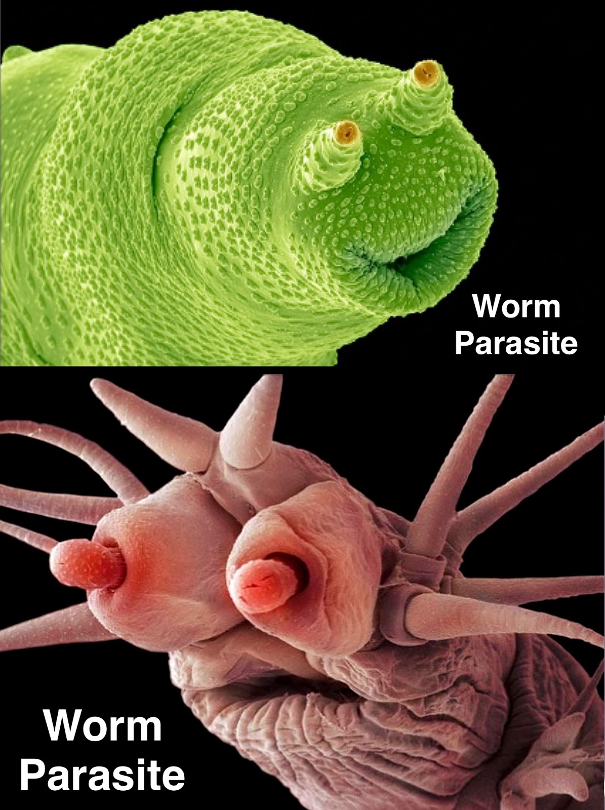 👈 Don't be scared!😨 Its just a WORM 🐛, worm under microscope