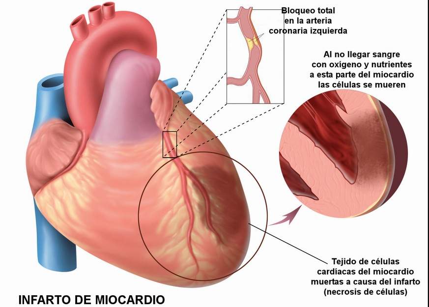 Cuestión de salud