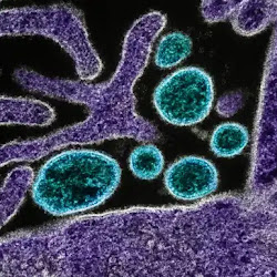 Vírus Nipah volta a causar mortes e contaminações no sul da Índia
