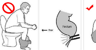 Alasan Toilet Jongkok Lebih Sehat Daripada Toilet Duduk - Luar Biasa