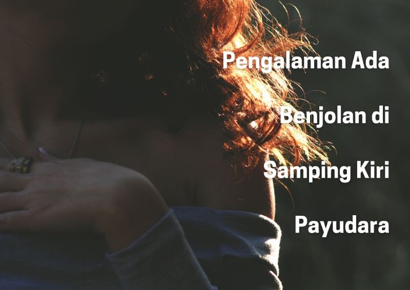 Pengalaman Ada Benjolan Di Samping Kiri Payudara