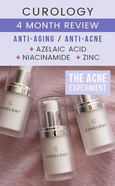 4 Month Curology Review - Azelaic Acid, Niacinamide, Zinc - The Acne Experiment