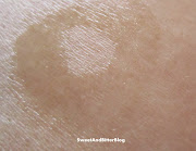 Pimple Relief RollOnGarnier Skin Naturals Pure Active Pimple Relief .