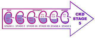 ckd stage 5