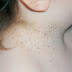 Skin problems(Cancers)...1