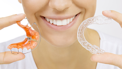 Tham khảo về chi phí niềng răng invisalign