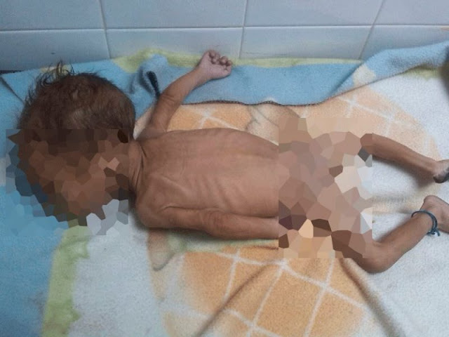 Miebtras el Regimen gasta el dinero de tus impuestos en rumbas: Muere bebé de seis meses por presunta desnutrición en el estado Aragua