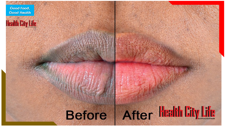 What your lip color says about your health, The color of your lips will tell you ways healthy you are