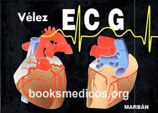 http://booksmedicos.org/pautas-de-ecg-velez-2a-edicion/