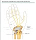 الدكتور صفوق العنزي : اهم مسببات متلازمة النفق الرسغي Carpel tunnel syndrome 