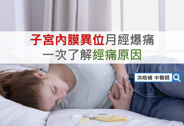 經痛,痛經,子宮內膜異位症,中醫,原因,子宮腺肌症,巧克力囊腫,洪皓脩中醫師