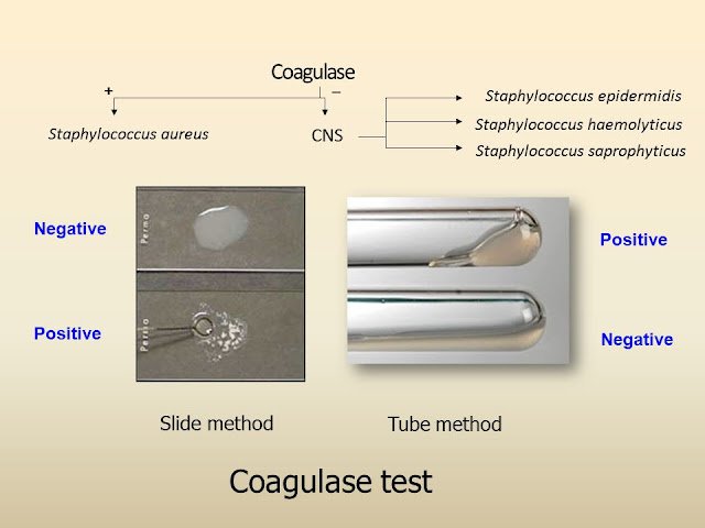  COAGULASE  TEST Microbiology Laboratory Turkey