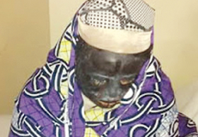 Couple Bathed With Acid While Making Love In Kano