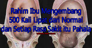 Fakta Tentang Rahim Ibu Mengembang 500 Kali Lipat dari Normal dan Setiap Rasa Sakit itu Pahala