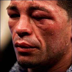 Arturo Gatti