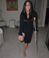 Beautiful girls amputee with crutches