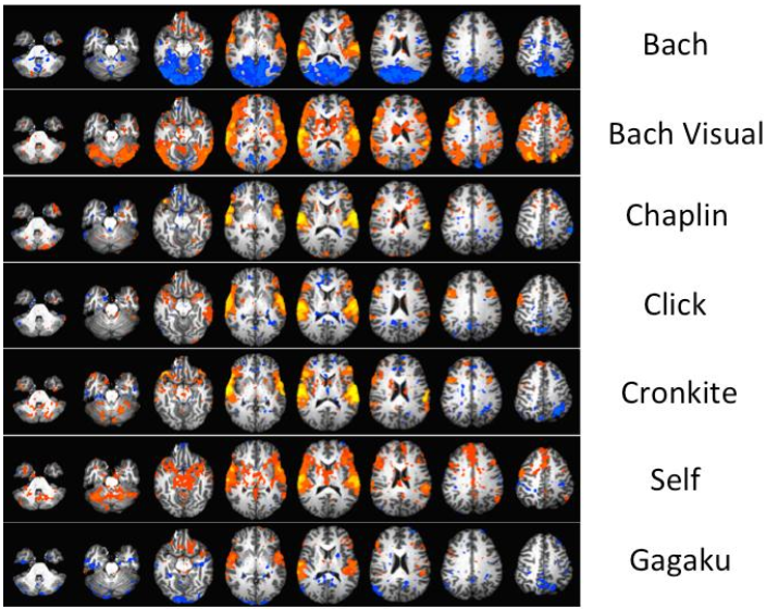 図：音楽の種類とfMRI