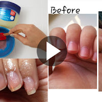See How To Grow Nails Naturally Within A Few Days!