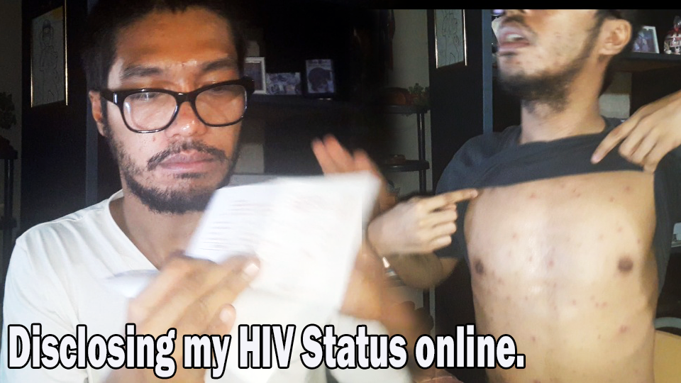 HIV and AIDS awareness, HIV prevention tips, what is HIV, what is AIDS, difference between HIV and AIDS, HIV transmission, how to prevent HIV, living with HIV, HIV support, HIV testing, HIV early detection, AIDS awareness, AIDS support, HIV/AIDS information, HIV and mental health, impact of HIV, HIV emotional support, advocating for HIV awareness, HIV-related stigma, support for people with HIV, HIV advocacy, HIV myths debunked, HIV transmission myths, HIV stigma in society, educating about HIV, HIV/AIDS education, HIV and relationships, HIV disclosure tips, HIV treatment options, managing HIV symptoms, HIV testing process, HIV diagnosis, HIV counseling, HIV support groups, HIV education resources, HIV and mental health support, HIV facts and myths, overcoming HIV stigma, HIV prevention methods, HIV resources, AIDS awareness month, how HIV is spread, understanding HIV/AIDS, HIV symptoms, HIV stages, HIV early signs, HIV treatment, AIDS symptoms, AIDS stages, HIV prevention techniques, safe sex education, HIV support resources, coping with HIV diagnosis, living with HIV/AIDS, HIV positive life tips, HIV support networks, HIV public health, breaking HIV stigma, HIV statistics, current HIV facts, understanding AIDS, preventing HIV transmission, HIV support organizations, HIV facts and myths, HIV/AIDS advocacy groups, HIV and community support, education on HIV, helping those with HIV, HIV awareness events, HIV/AIDS education programs, HIV awareness month events, HIV in the Philippines, HIV epidemic awareness, HIV testing sites, HIV awareness programs, support for HIV families, support for AIDS patients, HIV treatment access, spreading awareness of HIV/AIDS, breaking myths on HIV, HIV awareness in schools, HIV knowledge, HIV prevention education, youth and HIV awareness, HIV risk reduction, HIV prevention strategies, HIV/AIDS community outreach, HIV prevention education for youth, supporting people with HIV, fighting HIV stigma, stigma around HIV/AIDS, AIDS awareness events, AIDS awareness campaigns, HIV awareness groups, HIV/AIDS social impact, HIV and mental health, emotional effects of HIV, dealing with HIV diagnosis, mental support for HIV, coping with HIV, HIV anxiety, stress of living with HIV, psychological effects of HIV, mental health support for HIV, HIV and relationships, coping with AIDS, HIV positive mental health, emotional support for AIDS patients, HIV therapy options, overcoming HIV fears, HIV mental wellness, HIV counseling resources, HIV and self-acceptance, mental health for AIDS, AIDS psychological support, HIV emotional resources, mental wellness for HIV positive, managing HIV anxiety, HIV mental health services, HIV support counseling, self-care for HIV positive, mental health and HIV prevention, stress of AIDS diagnosis, HIV self-acceptance, overcoming stigma of HIV, self-support for HIV positive, HIV counseling programs, coping with stigma of HIV, HIV support therapy, HIV-related mental health services, HIV and therapy, HIV acceptance resources, dealing with HIV stigma, mental health support for AIDS, HIV counseling tips, mental effects of HIV, mental care for HIV, mental effects of HIV/AIDS, mental health for HIV patients, HIV support for mental wellness, HIV acceptance tips, HIV anxiety tips, coping with AIDS stigma, counseling for HIV patients, AIDS mental health support, HIV support networks for mental wellness  Stigma, Discrimination, and Social Issues Related to HIV/AIDS HIV stigma, discrimination against HIV, social stigma HIV, addressing HIV stigma, HIV stigma in society, breaking HIV stigma, HIV awareness to reduce stigma, stigma and HIV, HIV discrimination issues, HIV education to fight stigma, overcoming HIV stigma, support for HIV stigma, HIV stigma at work, combating HIV discrimination, social impact of HIV stigma, HIV support in society, reducing stigma of HIV, HIV stigma effects, social stigma and AIDS, tackling HIV stigma, HIV stigma reduction programs, overcoming stigma in HIV community, HIV acceptance and stigma, discrimination issues with HIV, HIV stigma resources, AIDS stigma impact, fighting AIDS stigma, HIV acceptance, social support for HIV stigma, HIV stigma in the workplace, workplace HIV stigma, reducing AIDS stigma, HIV positive stigma, combating AIDS discrimination, HIV/AIDS discrimination, stigma reduction for HIV/AIDS, society and HIV stigma, HIV stigma in families, stigma around AIDS, social acceptance of HIV, support to reduce HIV stigma, stigma against AIDS, overcoming social stigma HIV, community support HIV stigma, reducing HIV stigma campaigns, breaking social barriers HIV, stigma education HIV, reducing discrimination HIV/AIDS, HIV awareness and stigma, supporting HIV positive with stigma, social acceptance for HIV positive, community support HIV positive, HIV stigma support, fighting HIV discrimination