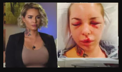 'If I Do Not Leave Now, I Will Die': Model Shares Chilling Story of Bloody Beating by 'War Machine'