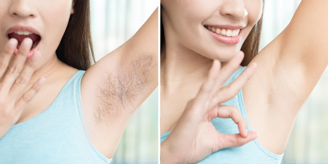 how much laser hair removal