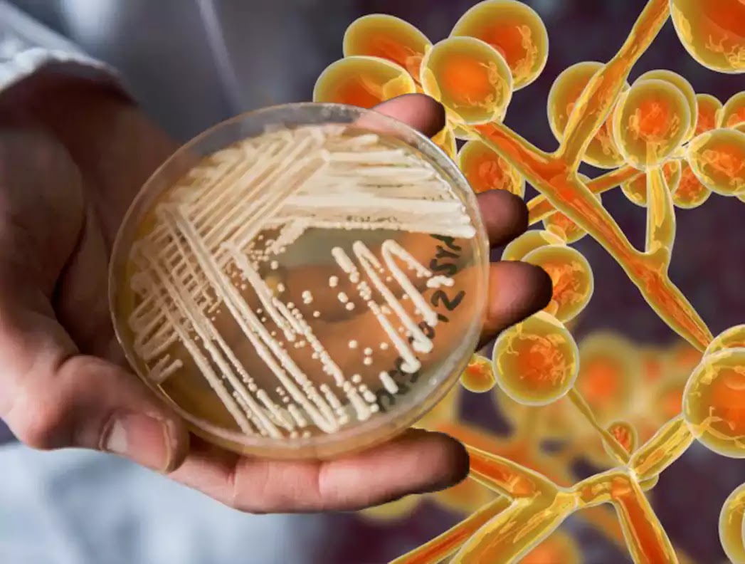 ivan-rodriguez-gelfenstein-candida-auris-fungus-that-spreads-at-an-alarming-pace-in-the-united-states