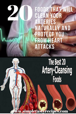 20 Foods That Will Clean Your Arteries Naturally And Protect You From Heart Attacks