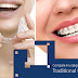 Comparing The Benefits of Invisalign Over Traditional Braces