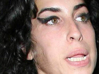 Amy Winehouse note the lanugo on her face