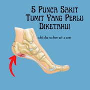 5 Punca Sakit Tumit Yang Perlu Diketahui