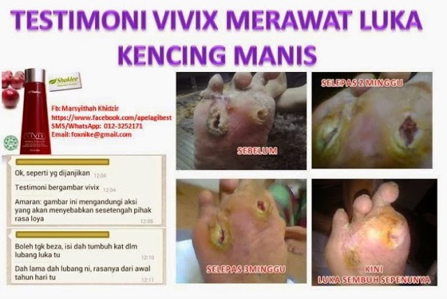 Ubat Kencing Manis KHAS Untuk Yang Tak Nak Potong Kaki 