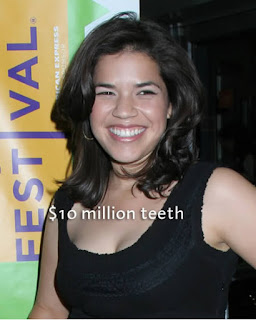 Actress America Ferrera had her teeth insured