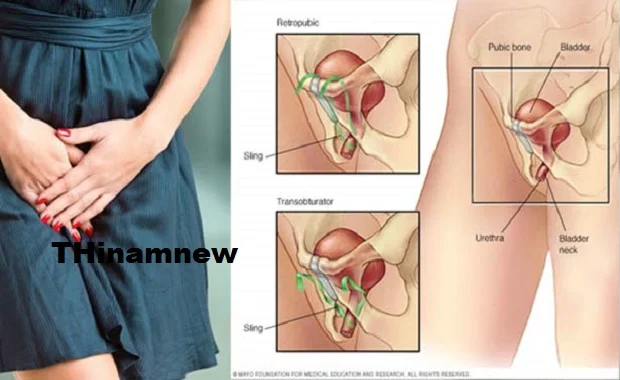 சிறுநீர் கழிவதில் பிரச்சனை