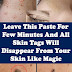Leave This Paste For Few Minutes And All Skin Tags Will Disappear From Your Skin Like Magic 