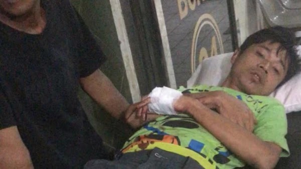 Adik Vicky Prasetyo Terluka Dibacok Begal